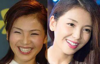 整形明星对比照片,揭秘美丽背后的秘密