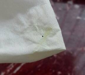 白带正常颜色的图片,自然色泽下的女性私密健康